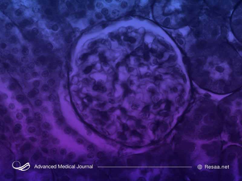 روش‌های درمانی متفاوتی برای سندروم آلپورت وجود دارد.