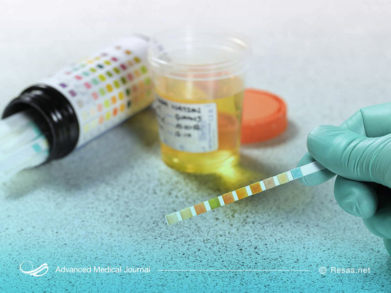 سندروم بارتر کلیه‌ها را تحت تاثیر قرار می‌دهد.