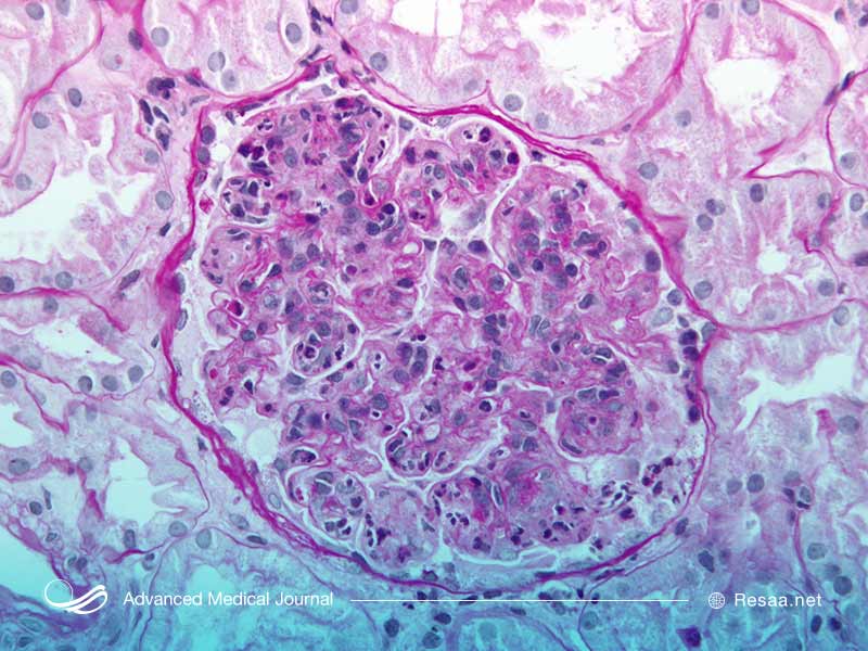 برای تشخیص سندروم بارتر میزان الکترولیت خون را اندازه می‌گیرند.