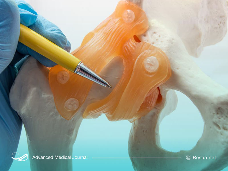 دیسپلاژی چیست؟