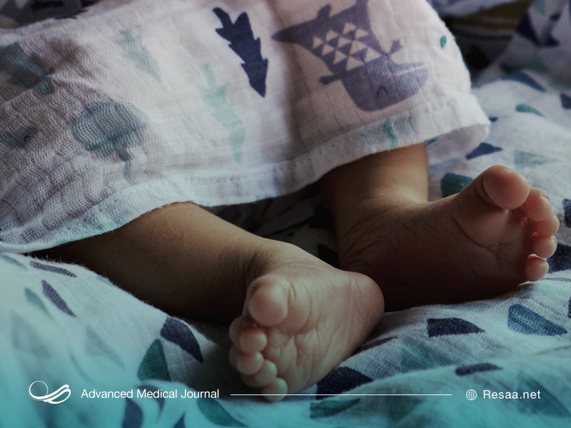 دیسپلاژی شدید