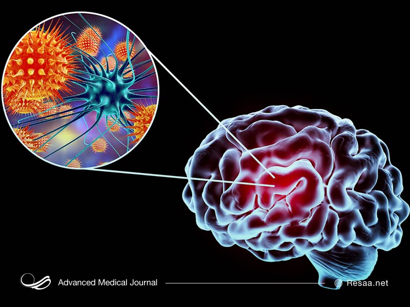 تب از علائم آنسفالیت است.