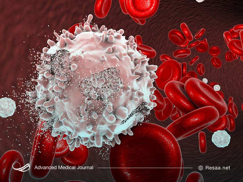هایپرکلسمی خانوادگی ممکن است منجر به پانکراتیت شود.