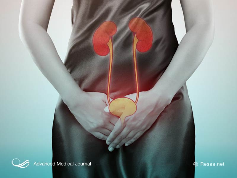 GN ممکن است باعث از دست دادن مقادیر بالای پروتئین از طریق ادرار شود.