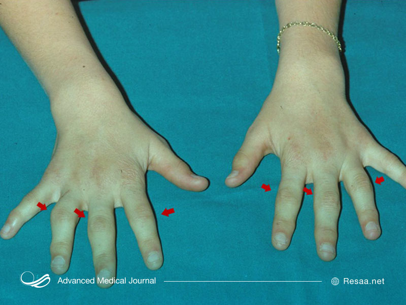 بیماری گرانولوماتوز را اید جدی گرفت.