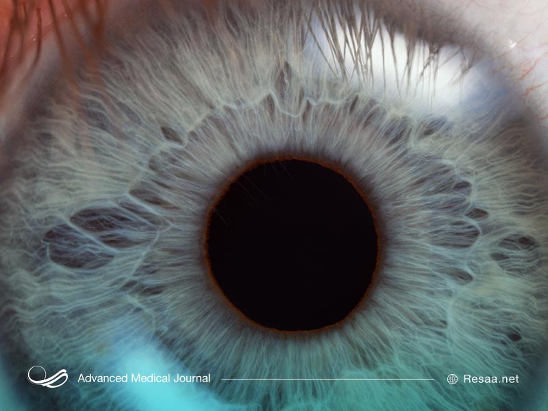 کراتوپاتی و وراثت