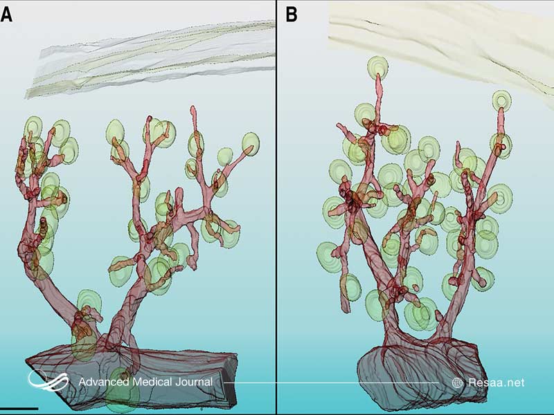 بیماری فون هیپل لیندو نوعی بیماری ژنتیکی است.
