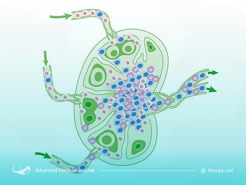 سرطان ممکن است به قسمت‌های مختلف گسترش یابد.