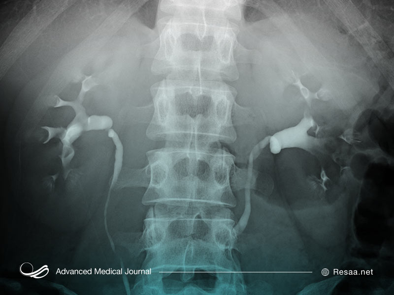 تصویربرداری از کلیه‌ها