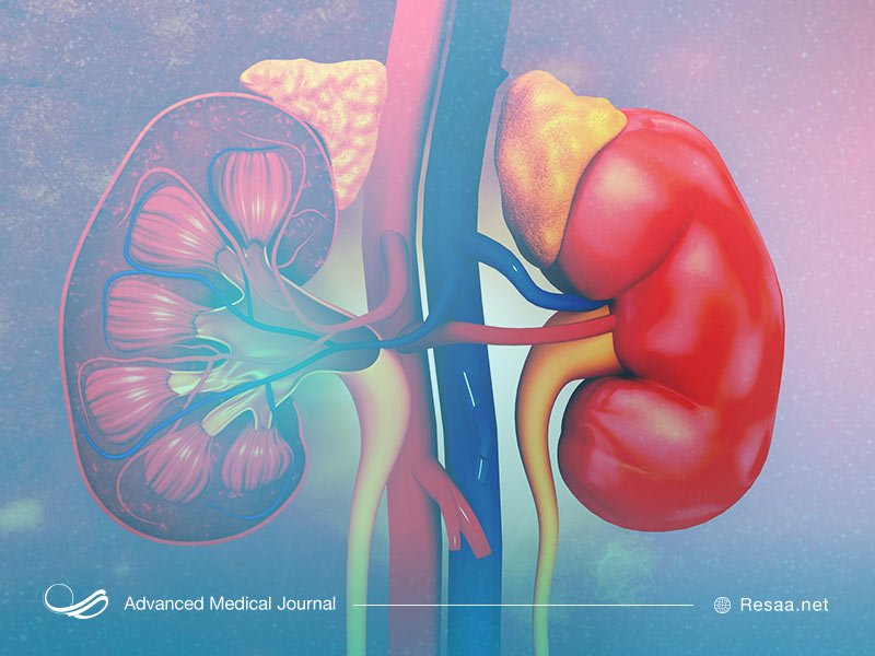 عفونت دستگاه ادرار از عوارض کلیه اسفنجی مدولار است.