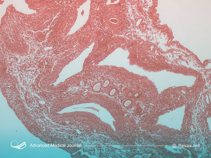 سونوگرافی می‌تواند وضعیت بیماری را مشخص کند.