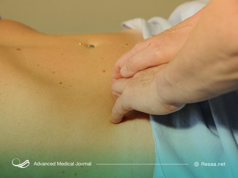 معاینه بدنی برای تشخیص متاستاز