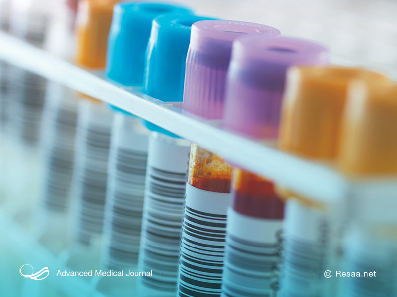 آیا ژنتیک در دیابت نفرولوژیک موثر است؟