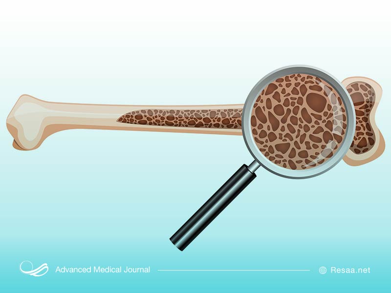 علت بیماری فئوکروموسیتوما ناشناخته است.