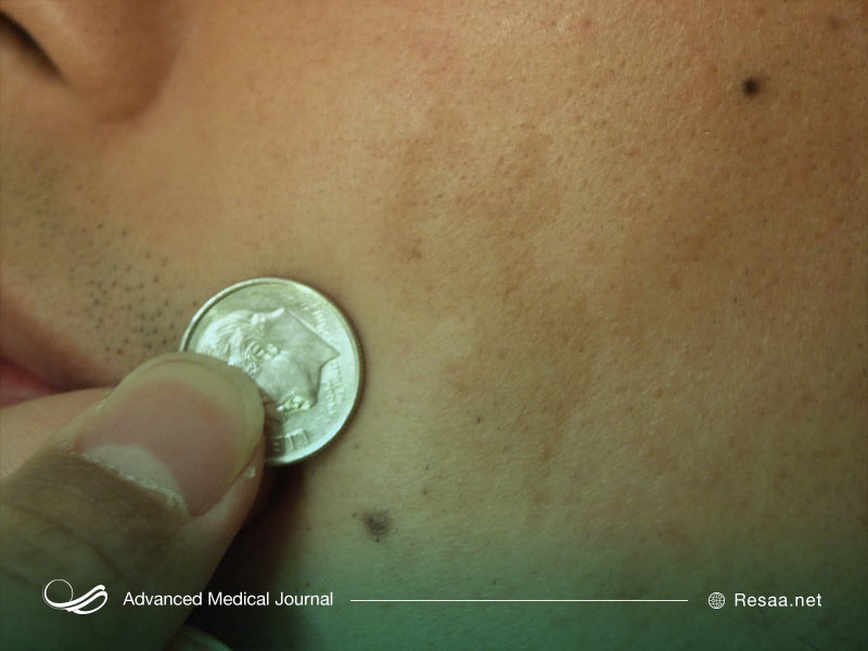 انتقال بیماری از والدین