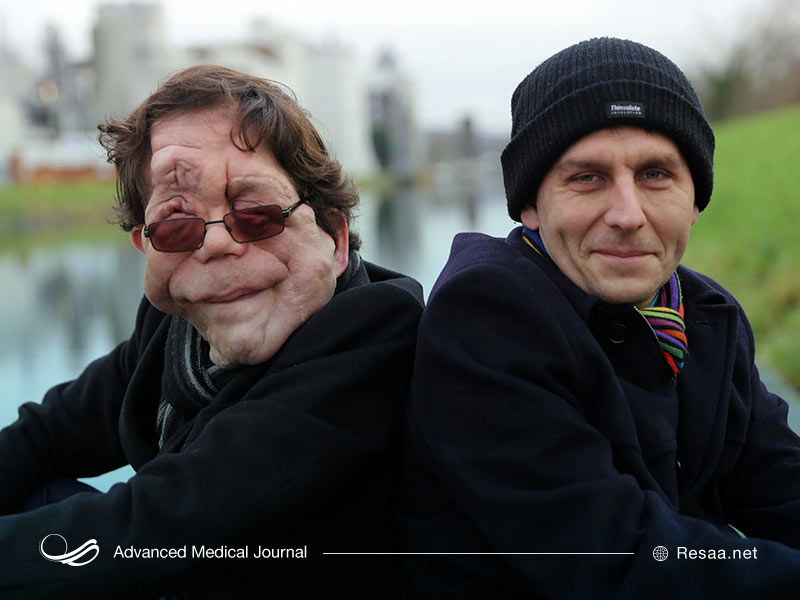 عوارض بیماری