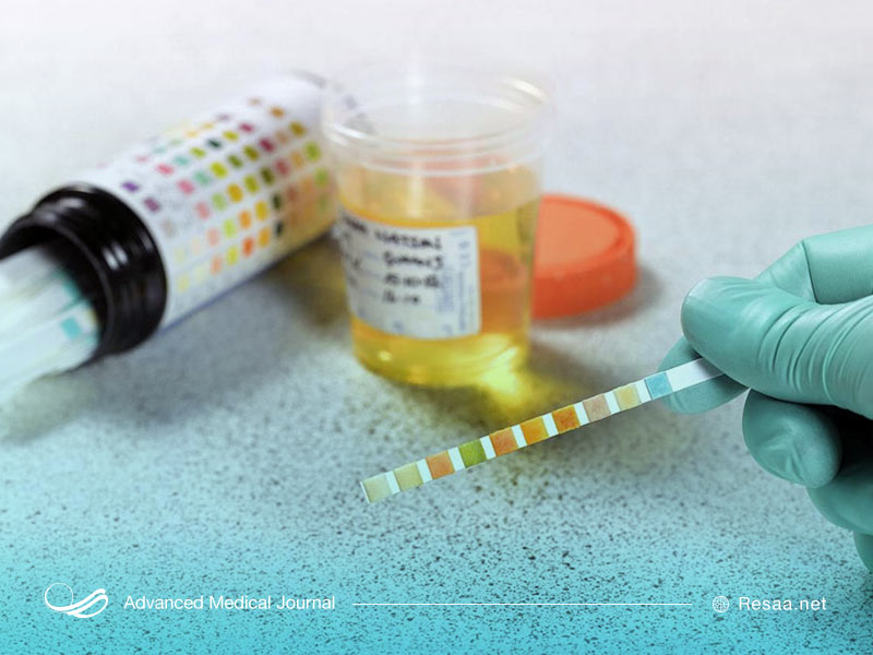 روش‌های درمانی کلیه پلی کیستیک