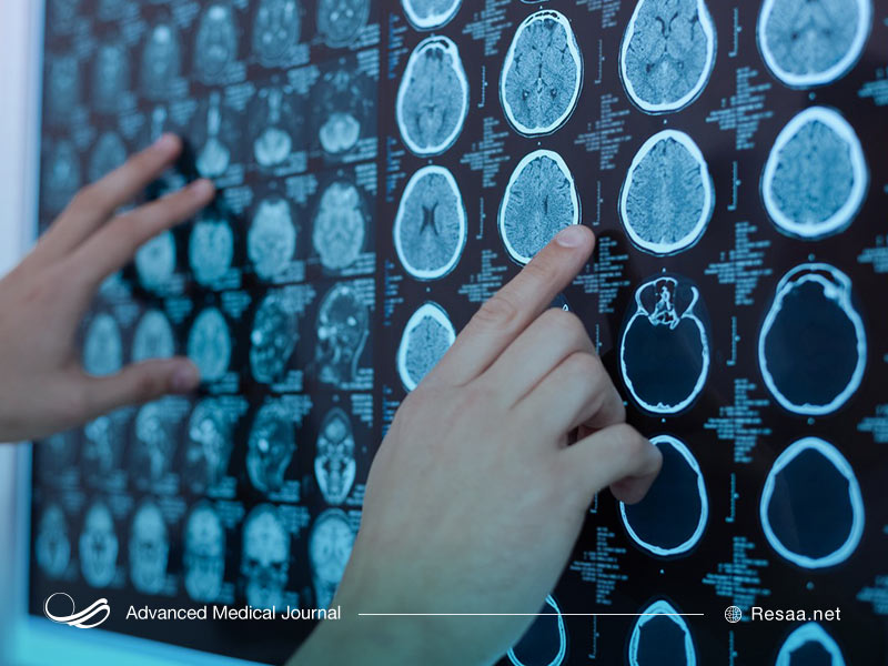 مشکلات ناشی از مصرف کلرودیازپوکساید