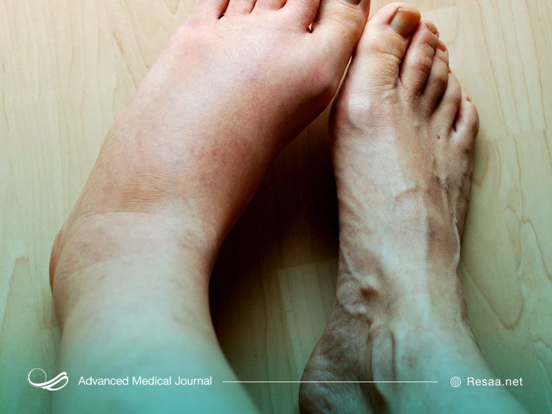 نوافن برای کاهش یا از بین بردن تب توسط بیمار استفاده می‌شود