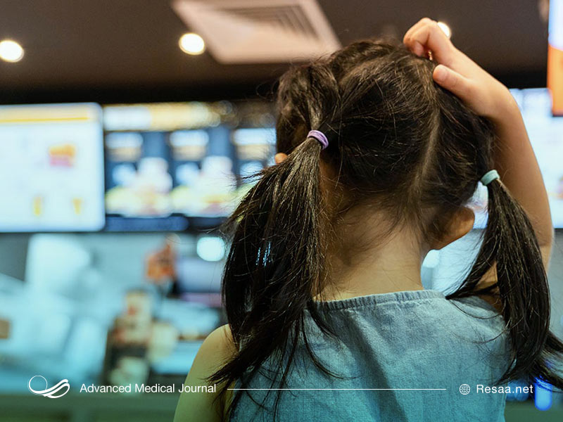 محصولات بدون نسخه (OTC) جهت درمان شپش سر