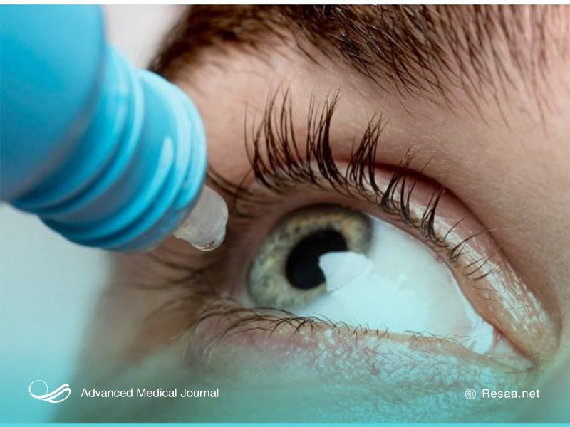 علل خشکی چشم چیست؟