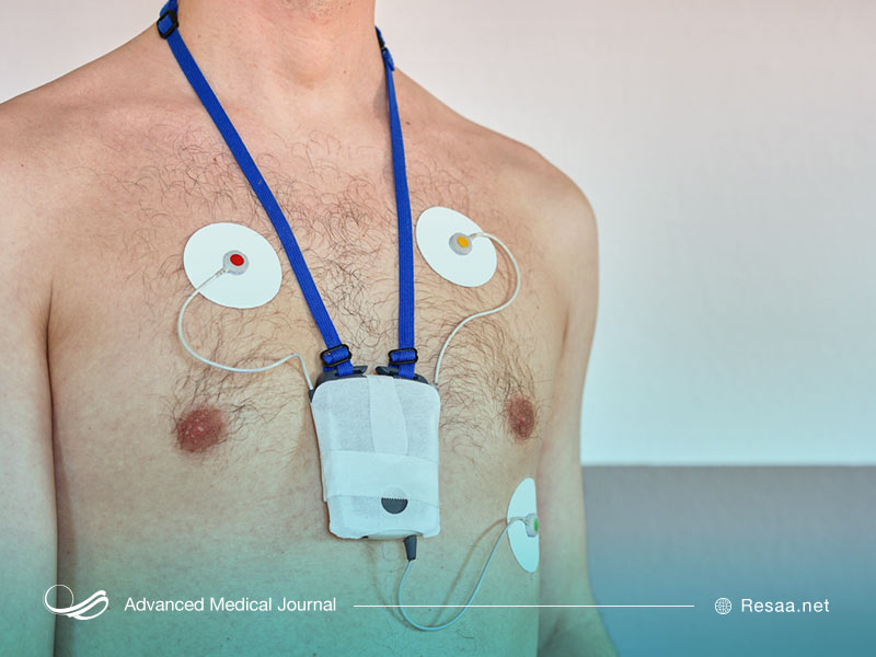 مانیتورینگ هولتر