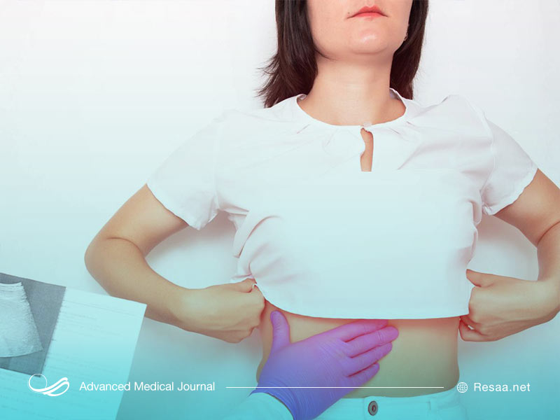 بیماری کبد چرب در دوران بارداری