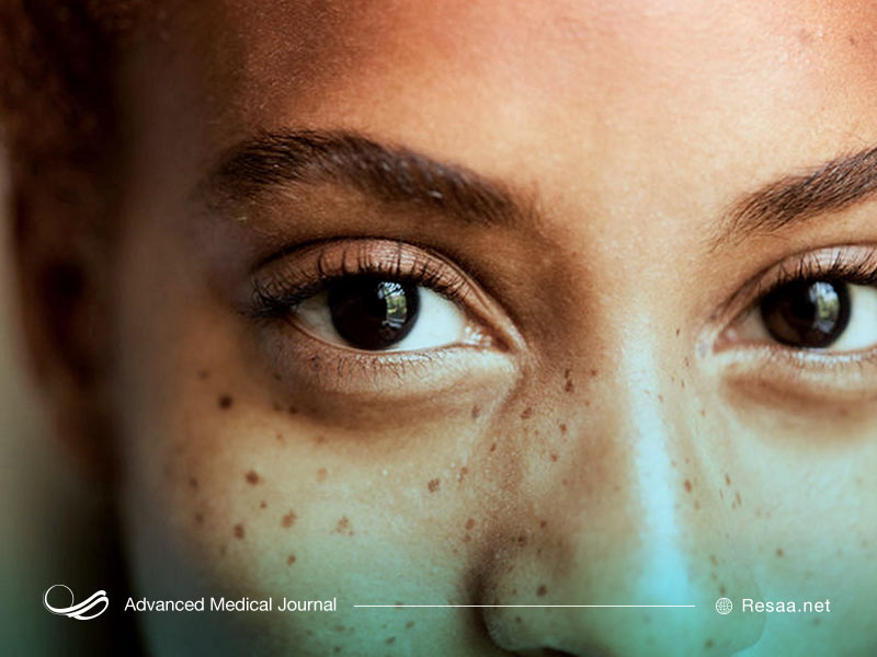 کتوتیفن چشمی چگونه باید استفاده شود