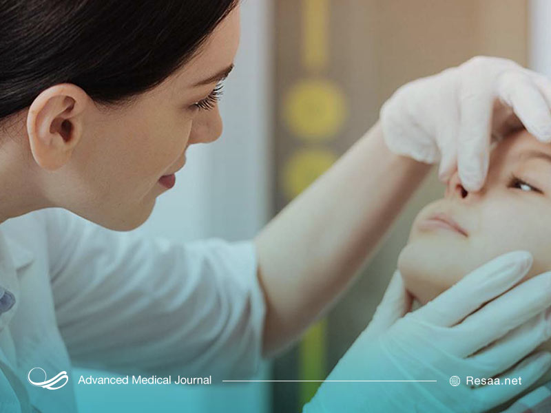 انحراف بینی