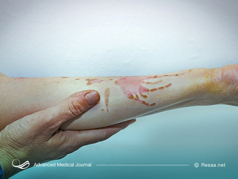 پارگی‌ها همان بریدگی