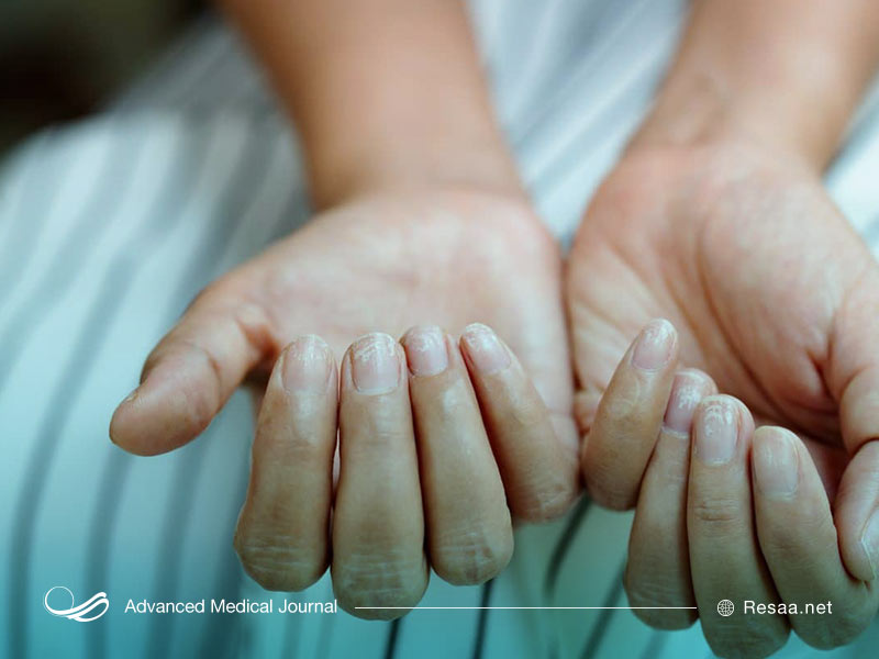 حساسیت پوستی